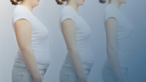 Imagem ilustrando a evolução da perda de peso, com três estágios de emagrecimento de uma mulher vista de perfil.